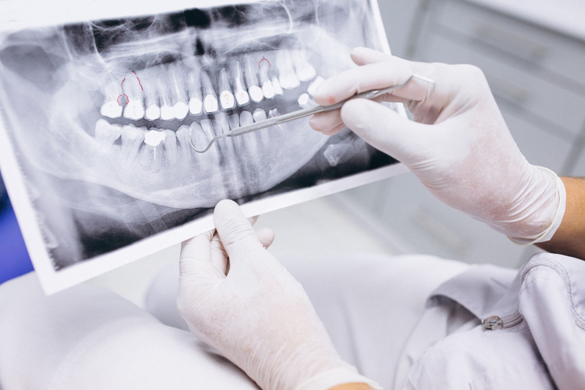 Inspeção detalhada para assegurar a conformidade técnica, qualidade de imagem e segurança no uso de equipamentos radiológicos odontológicos - Laudo Odontológico