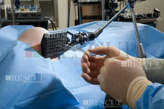 3208 - Treinamento em Manipulação De Fontes Seladas em Braquiterapia