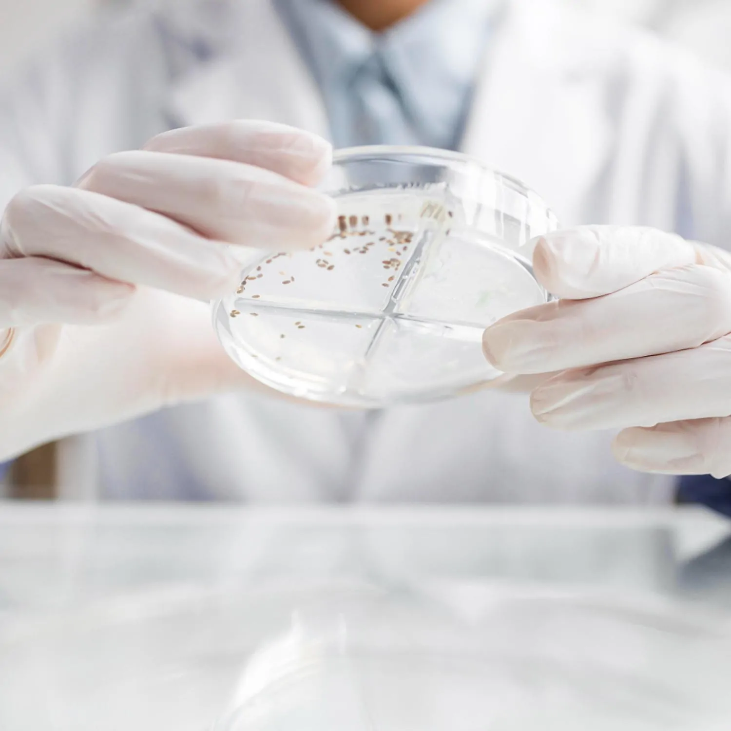Inspeção técnica de alimentos com o objetivo de detectar e controlar agentes microbiológicos, assegurando a integridade do produto - Laudo Microbiologia Alimentos Consumo